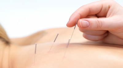 Dry Needling Agulhamento a seco
